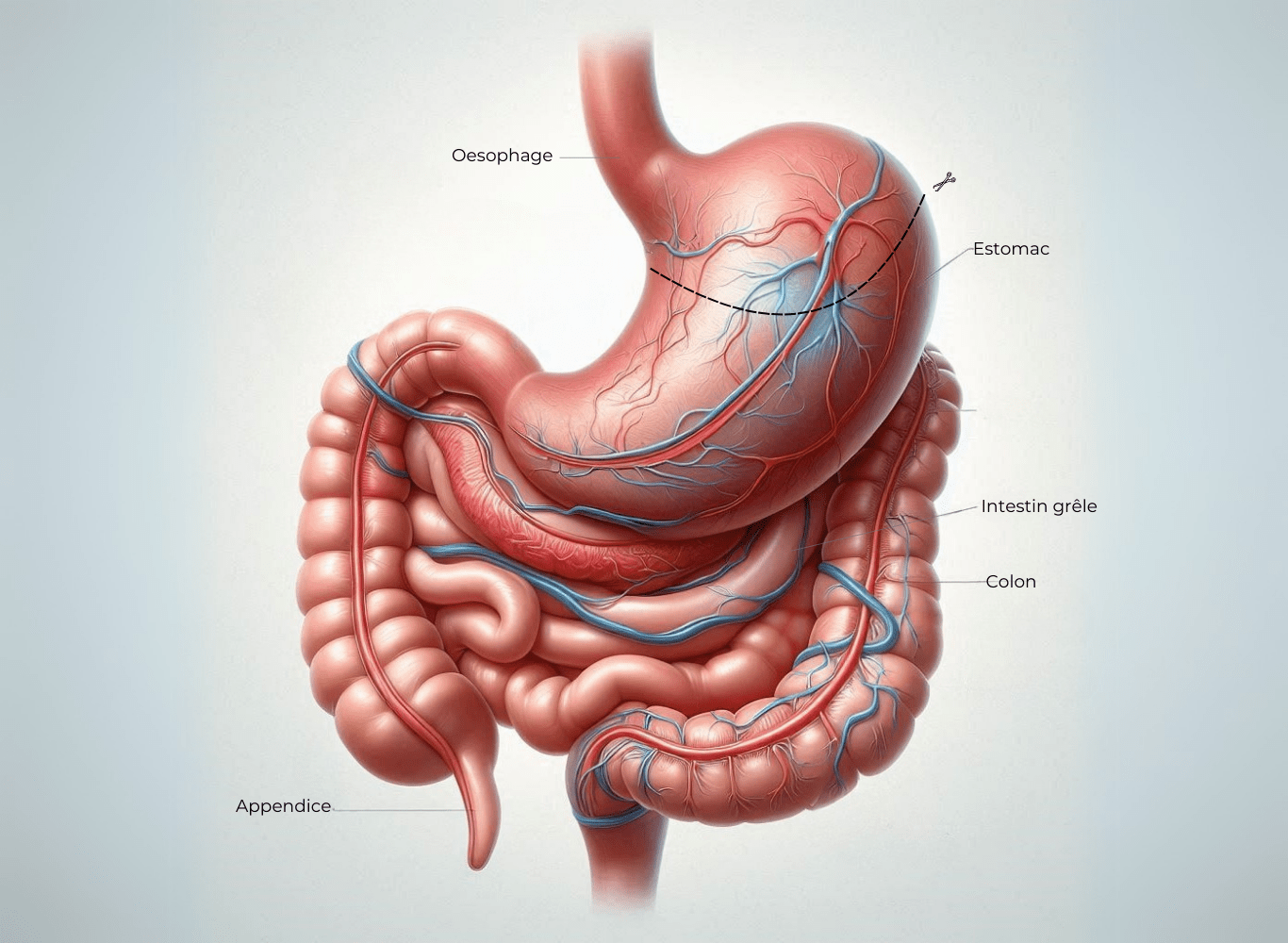 système digestif, anneau gastrique, intervention chirurgical, bypass Une séance d’hypnose pour poser l’anneau gastrique virtuel
